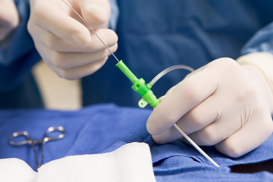 cardiac catheterization