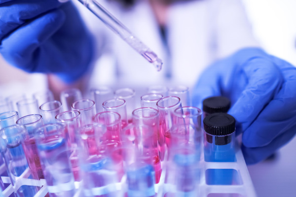 a lab technician wearing blue gloves is doing research with test tubes in the laboratory