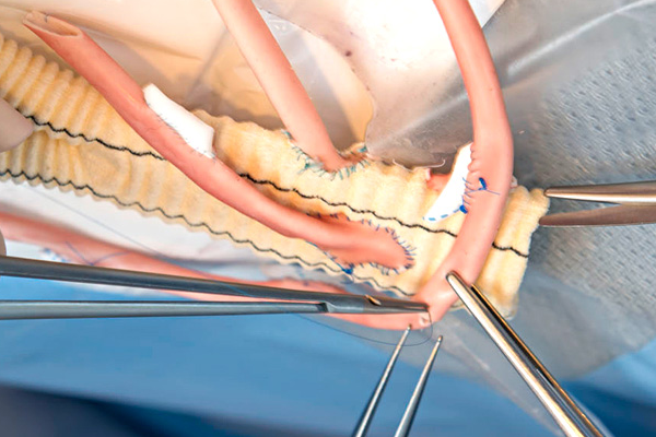 Close up image of simulation surgery