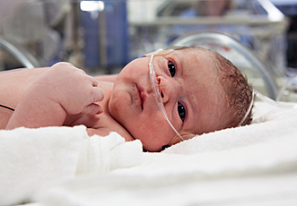 Baby in NICU with canula