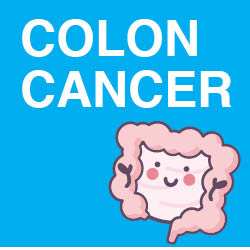 Colon Cancer graphic