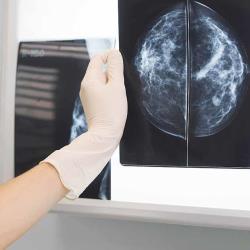 doctor holding mammography250
