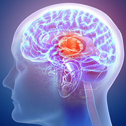 brain damageneurological effects1_250x250