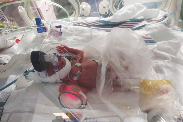 Elariya in the NICU with life-saving medical equipment