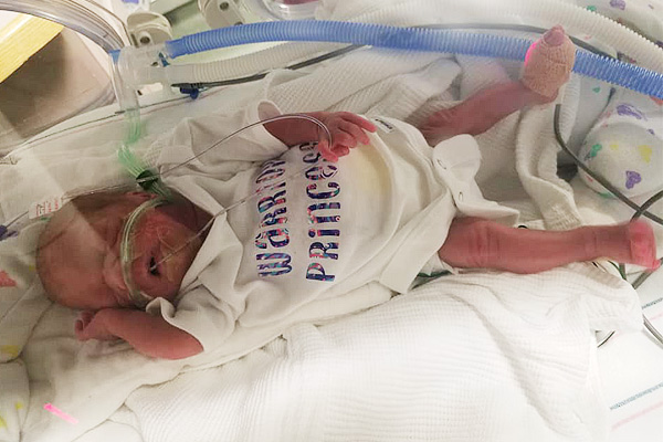 Elariya in the NICU with life-saving medical equipment