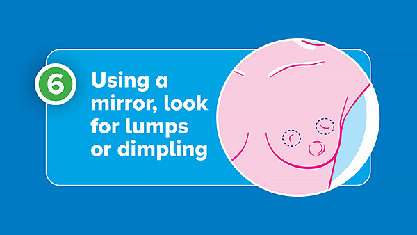 an illustration showing examples of breast lumps or dimpling