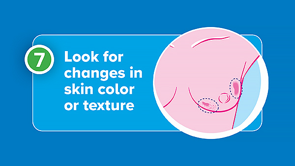 examples of changes in breast skin color or texture