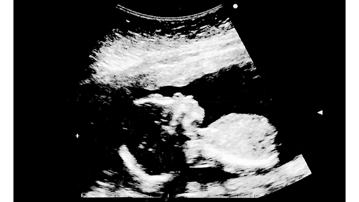 pregnancy baby ultrasound