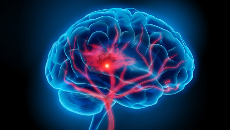 illustration of the human brain with the nerves highlighted in bright red